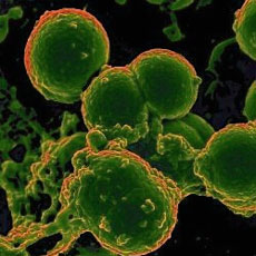 ВОЗ подтверждает девятую смерть от нового коронавируса, похожего на ТОРС